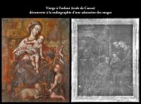 ETUDE RADIOGRAPHIQUE IMPORTANTE , chantal ouairy